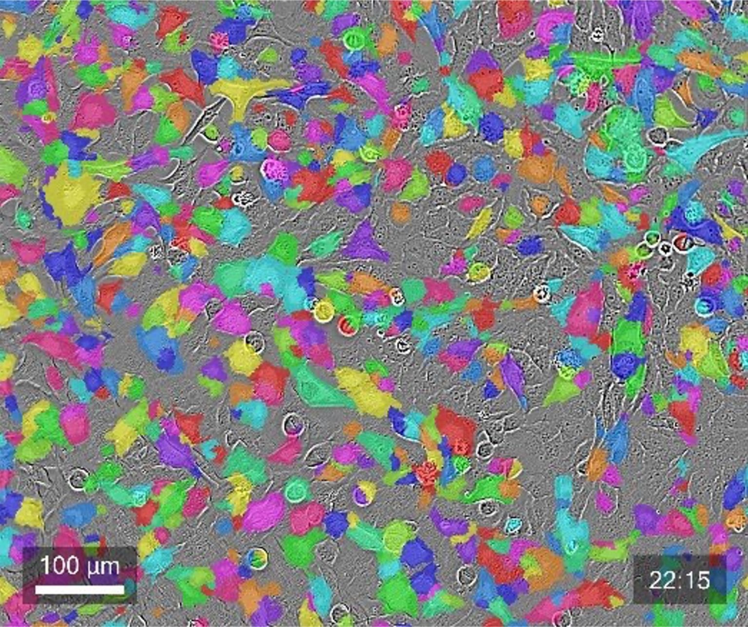 Cellcyte 1 - Live Cell Imaging Solution - Discover Echo